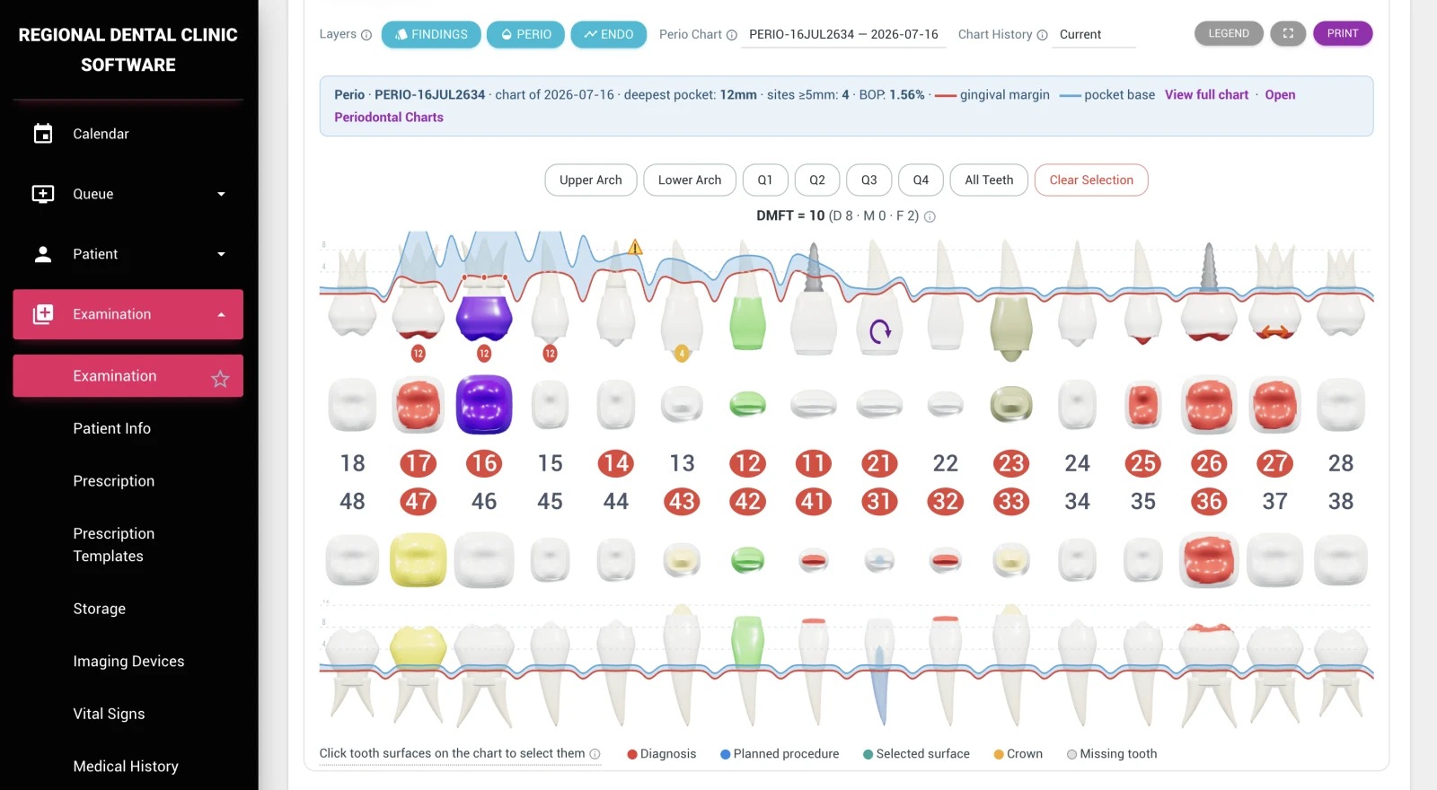 3D Dental Charting & Examinations — DentalKing dental software