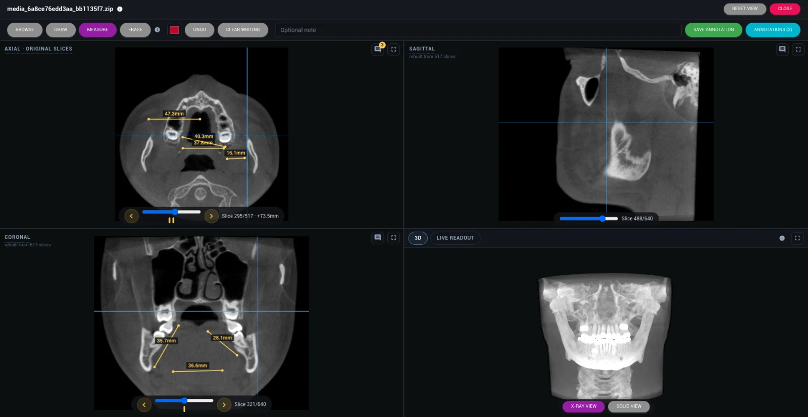 CBCT & 3D Imaging Viewer (MPR) — DentalKing dental software