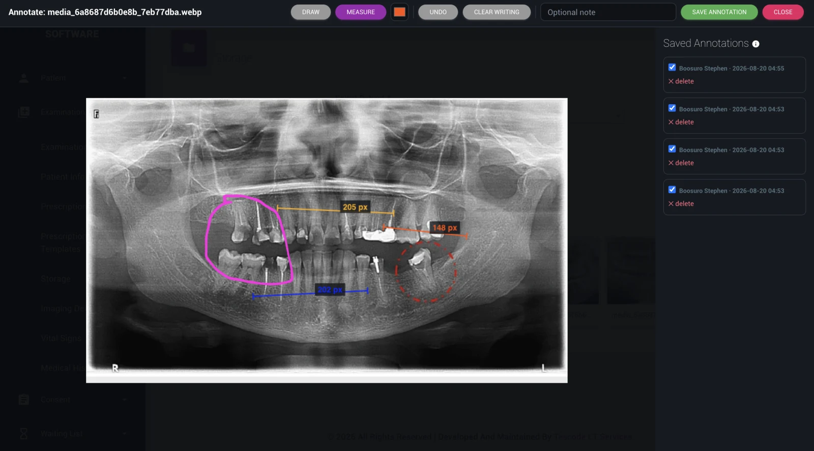 X-ray Viewer & Annotations — DentalKing dental software