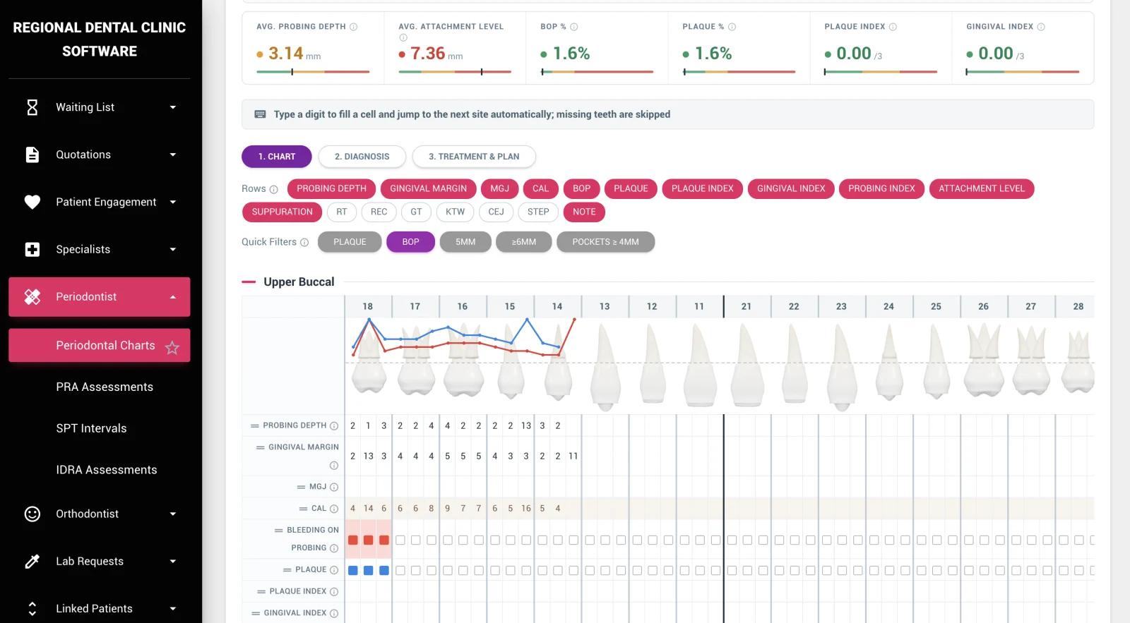 Periodontal Charting — DentalKing dental software