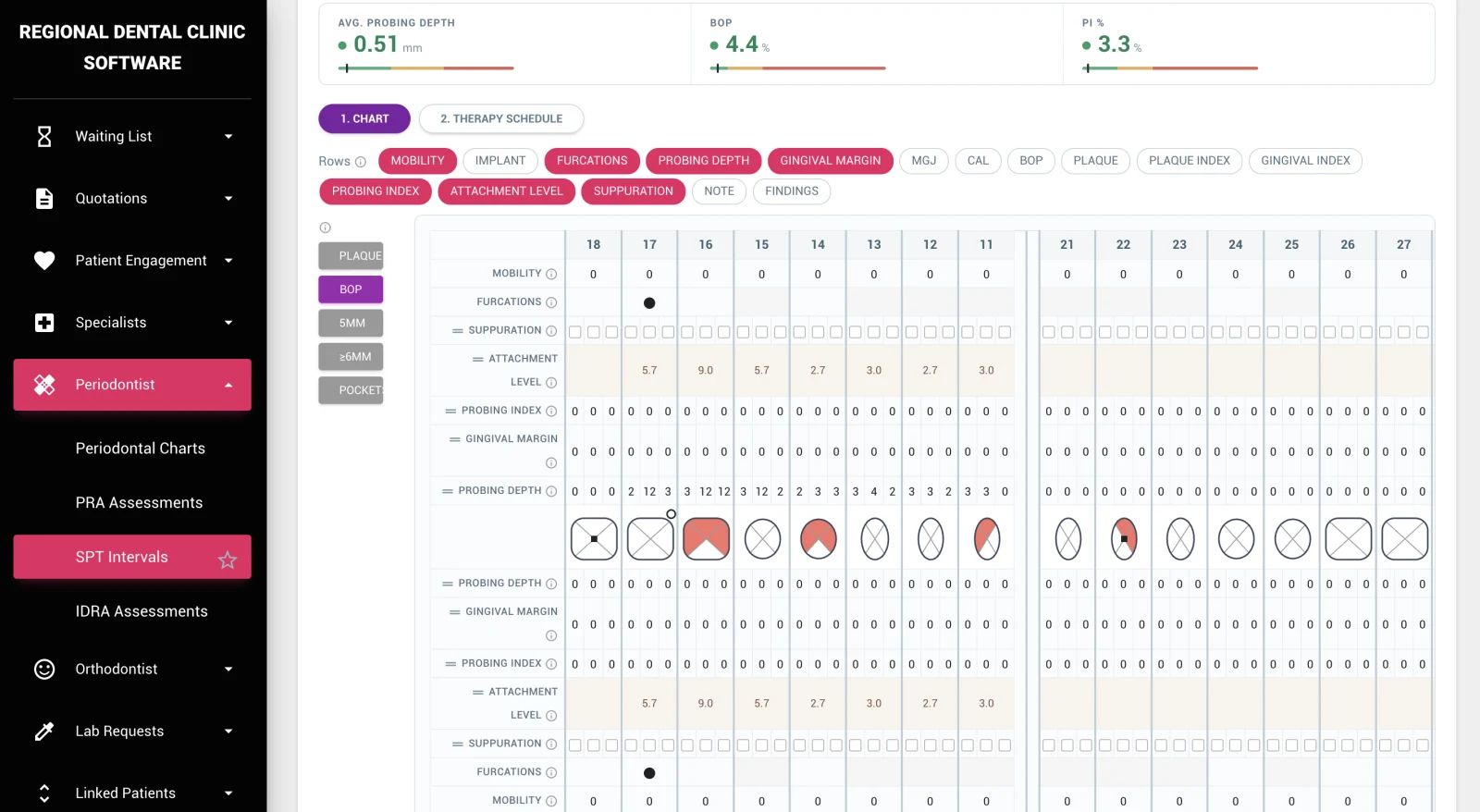 Supportive Periodontal Therapy (SPT) — DentalKing dental software